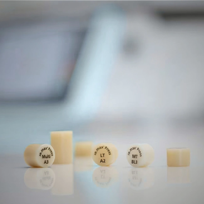 What Are Veneers Made Of?