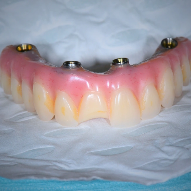 Emergency Dental Care in Applecross