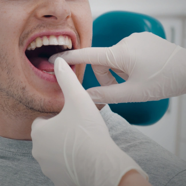 Mouthguards in Applecross