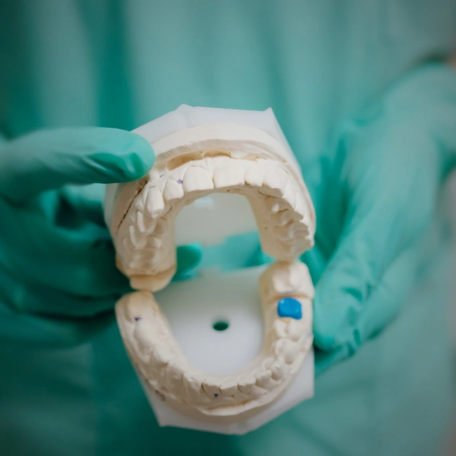 Why Gum Disease Happens