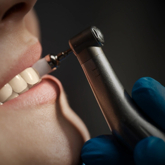 Gum Disease Treatment at Revive Dental