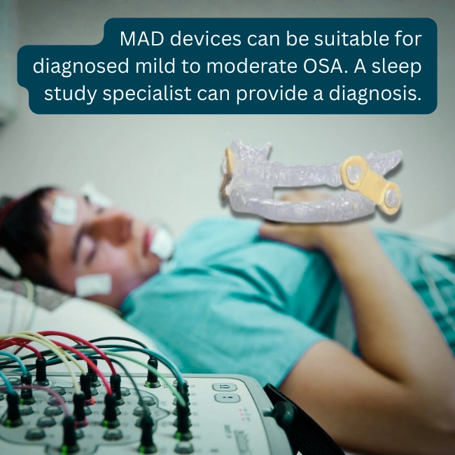 Oral Appliances for OSA