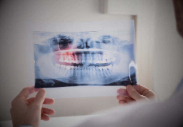 What to Expect & Supporting Your Smile