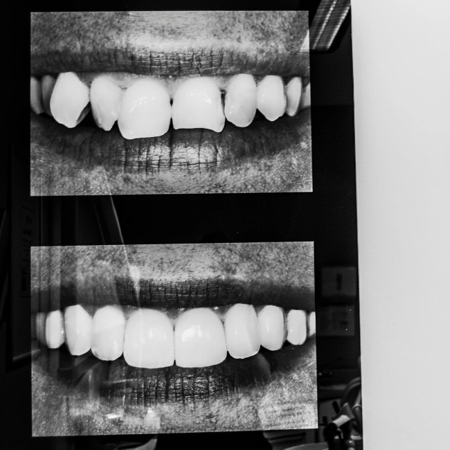 Alternate and Complimentary Solutions