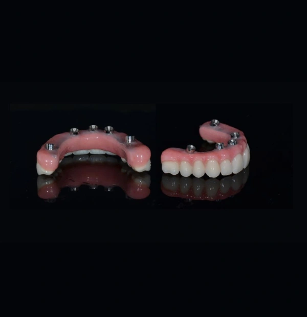 Dental Implants in Applecross