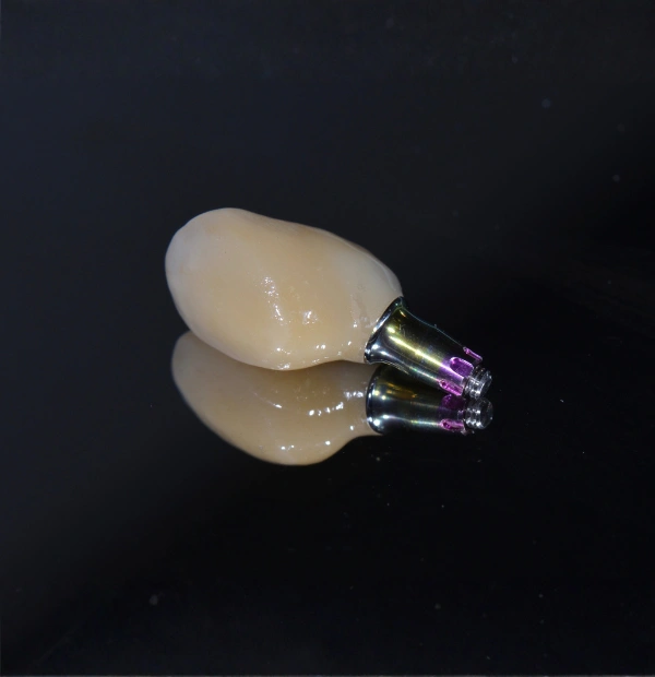 Why Choose Dental Implants