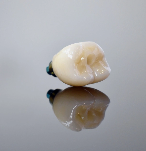 Single Dental Implants from $4,500