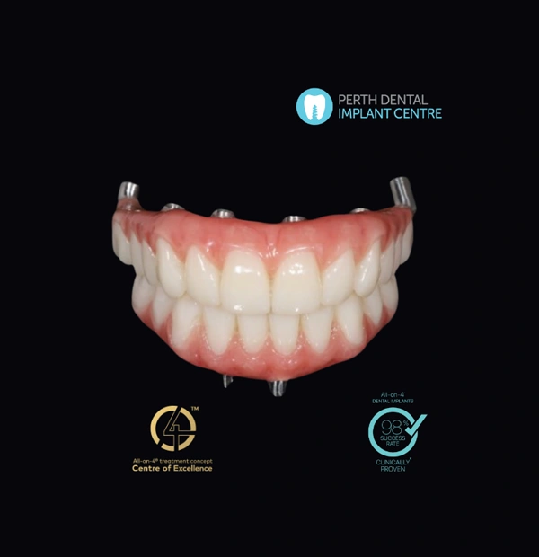 All On 4 Dental Implants